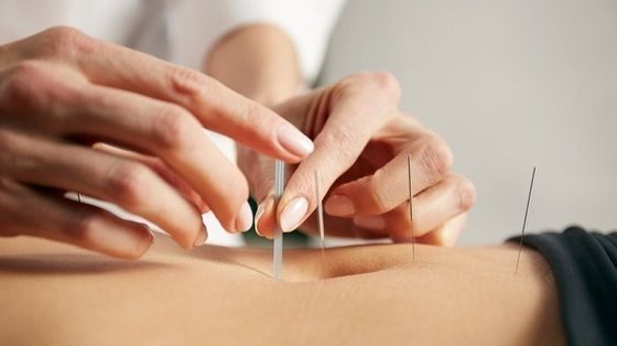 Kozmetik ve Tıbbi Intradermal Akupunktur İğneleri Akupunkturda Güvenliği ve Etkinliği Sağlayan Düz Yapı