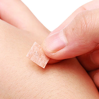 Keskin İğne Ucu Paslanmaz Çelik Akupunktur Nokta İğneleri Hassas Performans İçin