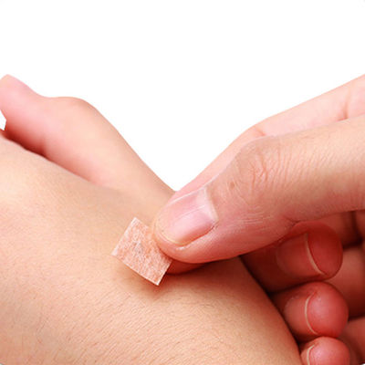 GB 2024-2016 Çin Tıbbı Cihaz Özellikleri Güvenlik Standardı için Akupunktur Basın İğneleri 0.2mm X 1.5mm